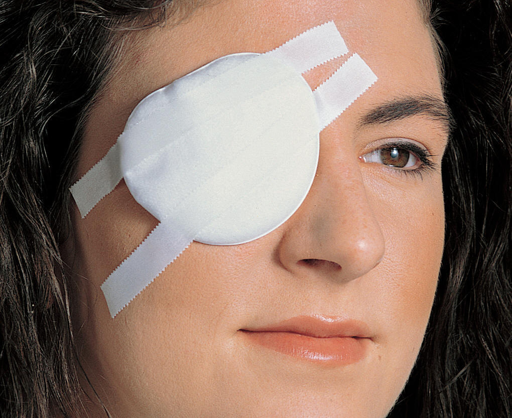 Как сделать повязку на глаз для лечения